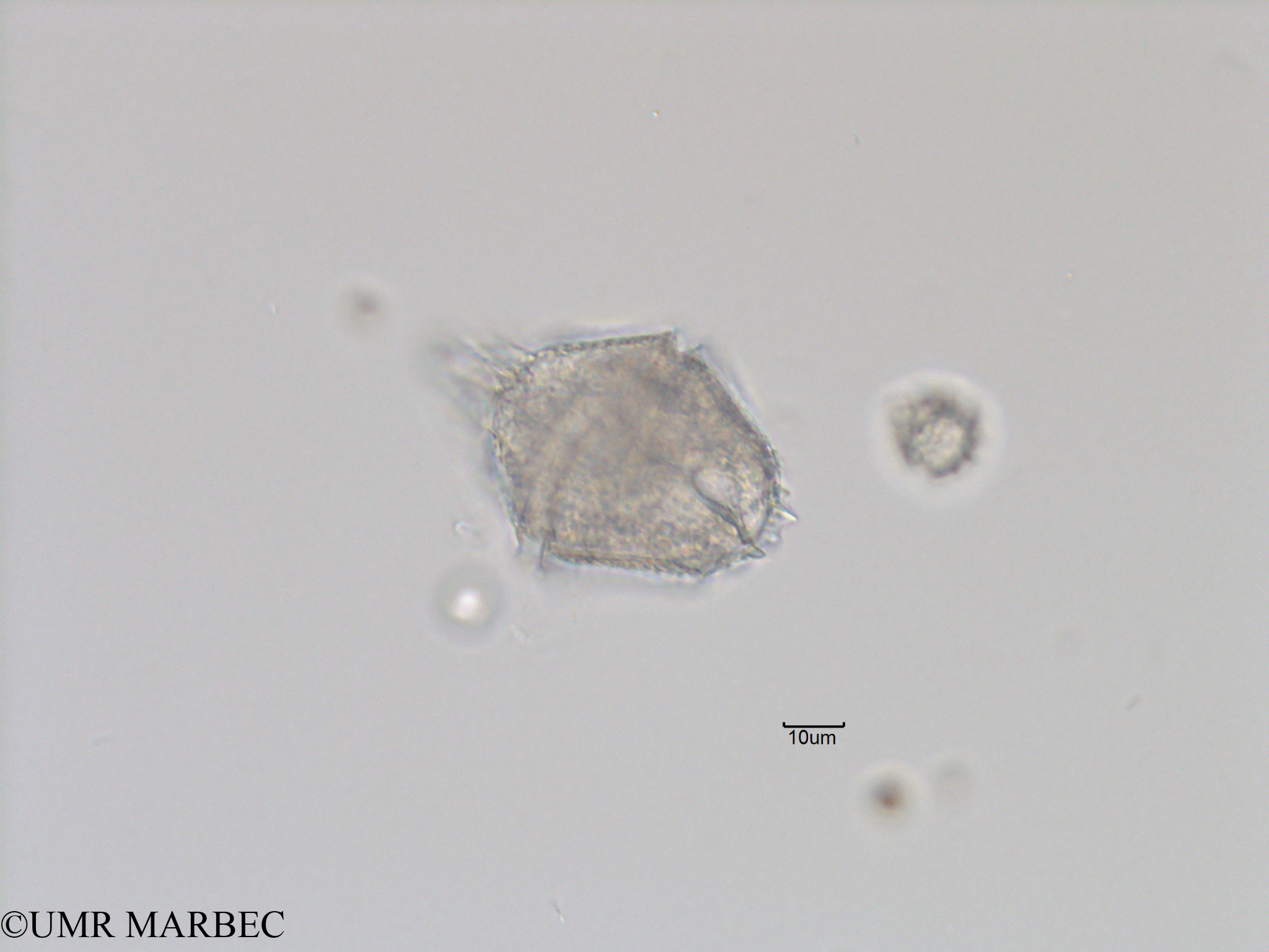 phyto/Bizerte/bizerte_bay/RISCO November 2015/Gonyaulax digitale (Baie_T5-C2-3 Gonyaulax spinifera-8).tif(copy).jpg